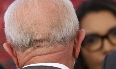 lula-recebe-liberacao-medica-para-viajar-de-aviao