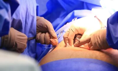 camara-aprova-projeto-que-obriga-divulgacao-de-lista-de-espera-do-sus