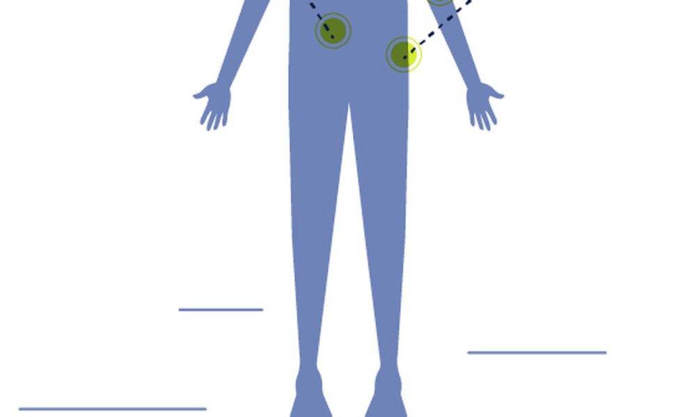 pacientes-com-neuroblastoma-aguardam-inclusao-de-medicamento-no-sus