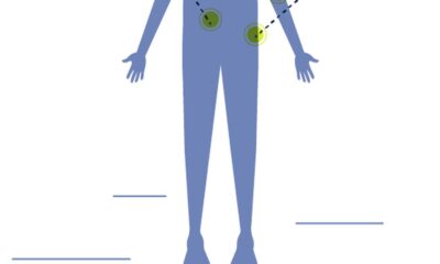 pacientes-com-neuroblastoma-aguardam-inclusao-de-medicamento-no-sus