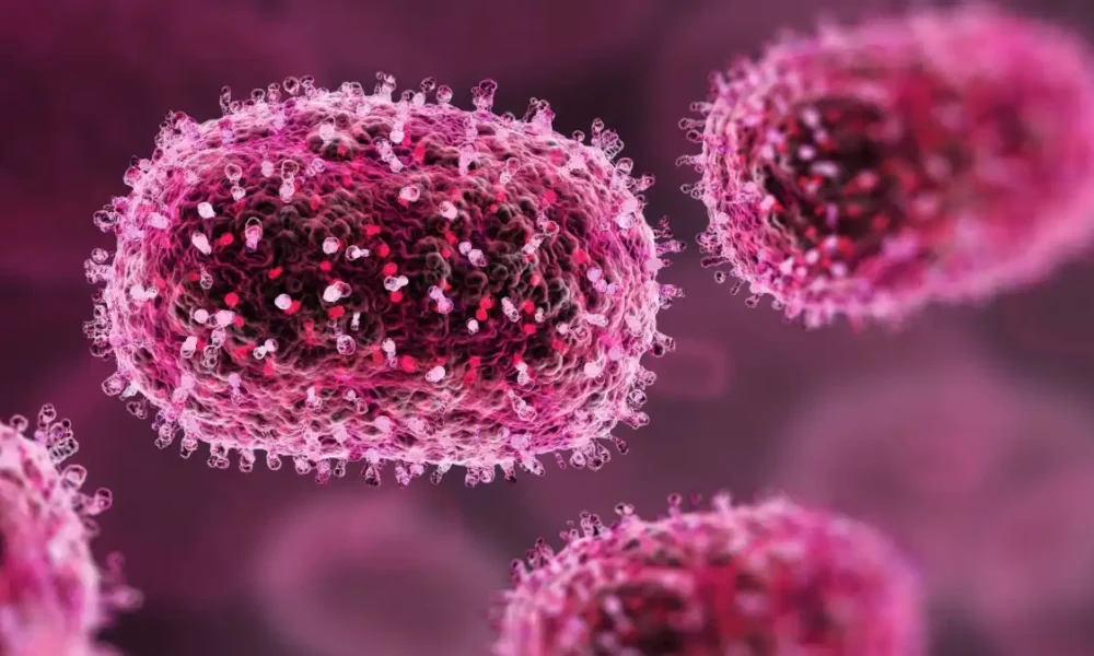 casos-de-mpox-no-brasil-este-ano-ja-superam-o-total-de-2023-–-folha-de-dourados-–-noticias-de-dourados-ms-e-regiao