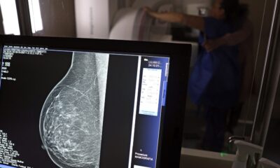 outubro-rosa:-mulheres-tem-exames-gratuitos-na-rodoviaria-de-brasilia