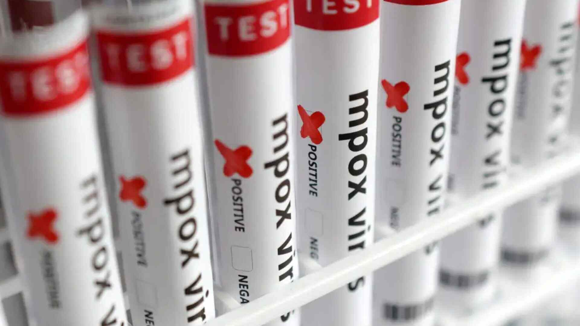 brasil-contabiliza-1,5-mil-casos-de-mpox-em-2024