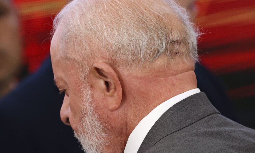 lula-fara-novo-procedimento-medico-nesta-quinta
