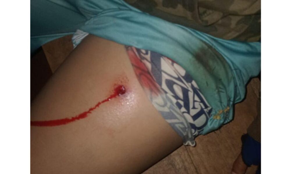 novo-ataque-no-parana-deixa-mais-quatro-indigenas-feridos