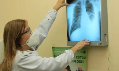dourados-intensifica-acoes-para-o-combate-a-tuberculose-–-portal-prefeitura-de-dourados