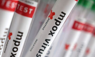 regiao-norte-do-brasil-registra-casos-de-mpox