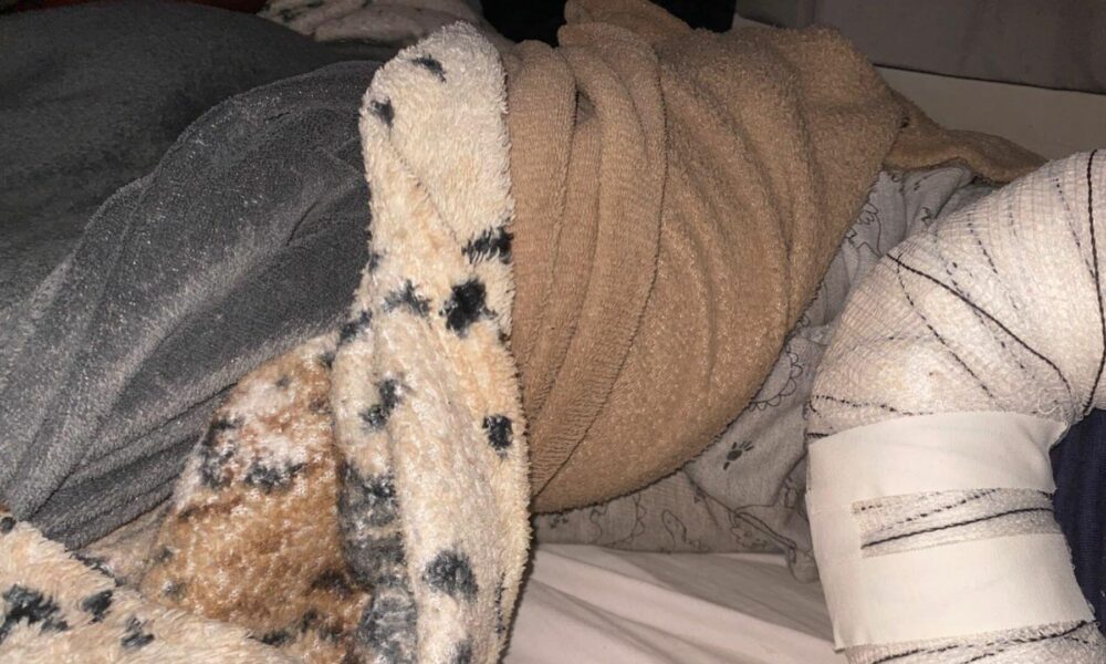 mae-denuncia-creche-apos-filho-ter-o-braco-deslocado-ao-cair-em-solario