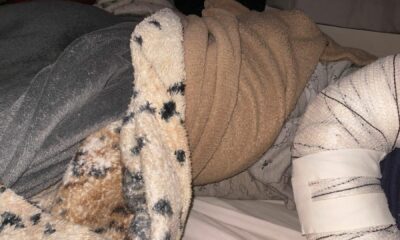 mae-denuncia-creche-apos-filho-ter-o-braco-deslocado-ao-cair-em-solario