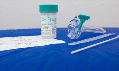 saiba-como-e-o-novo-teste-do-sus-para-detectar-cancer-do-colo-do-utero