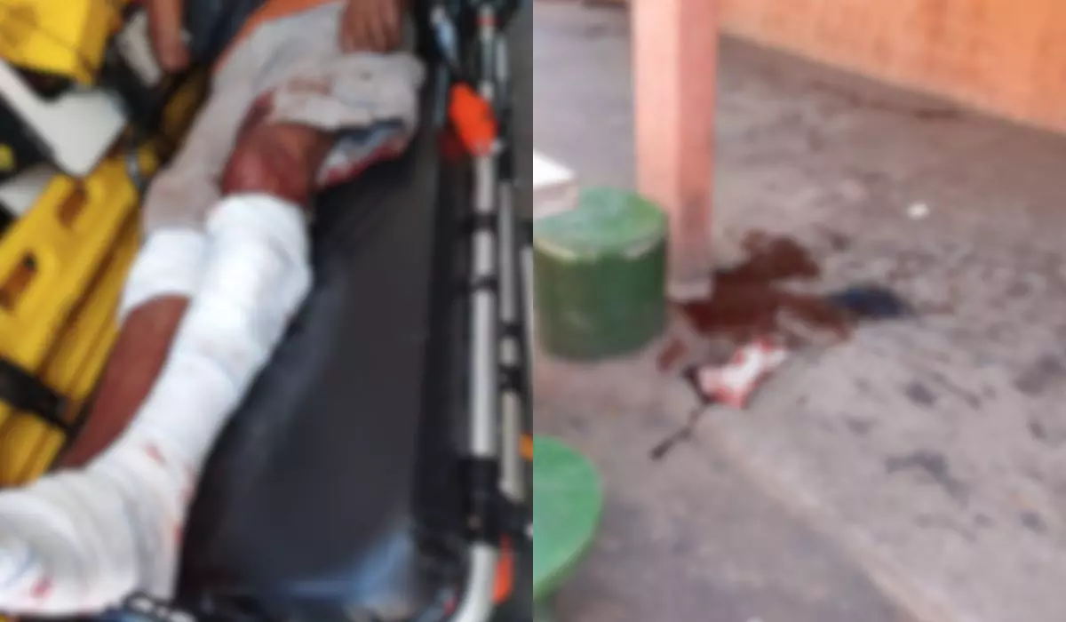 ms:-vitima-de-ataque-canino-e-encaminhada-a-upa-com-ferimentos-nas-pernas-–-folha-de-dourados-–-noticias-de-dourados-ms-e-regiao