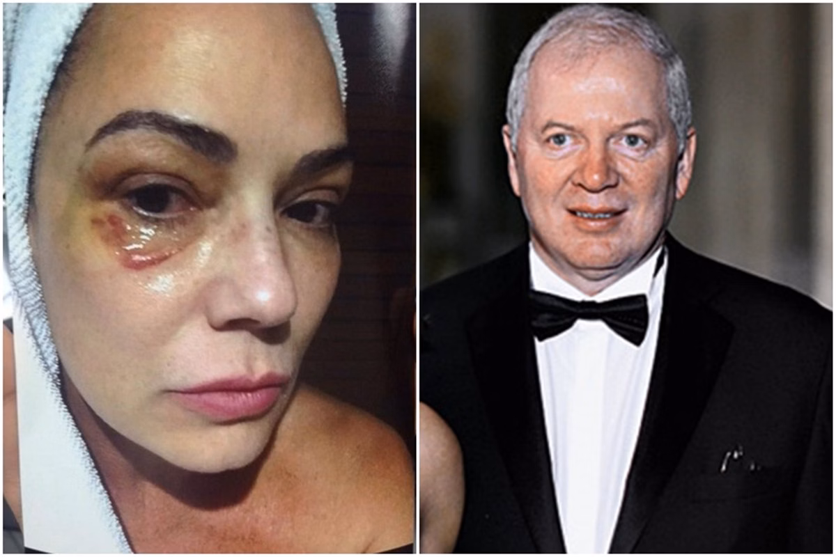 luiza-brunet-pede-indenizacao-de-r$-1-milhao-a-ex-marido-por-agressao-–-folha-de-dourados-–-noticias-de-dourados-ms-e-regiao
