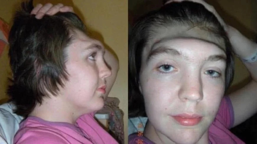 mulher-perde-parte-do-cranio-apos-acidente-–-folha-de-dourados-–-noticias-de-dourados-ms-e-regiao