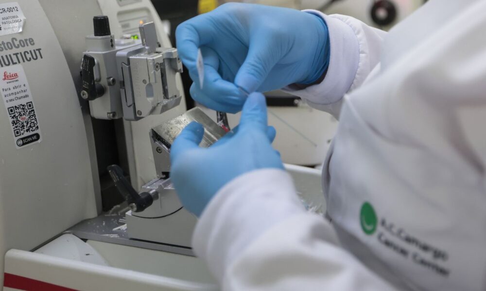 cura-de-cancer-de-prostata-pode-chegar-a-ate-98% 