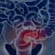 pacientes-com-cancer-colorretal-sao-diagnosticados-em-estagio-avancado