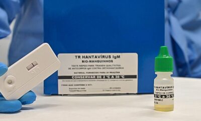 novo-teste-faz-diagnostico-de-hantavirose-em-20-minutos