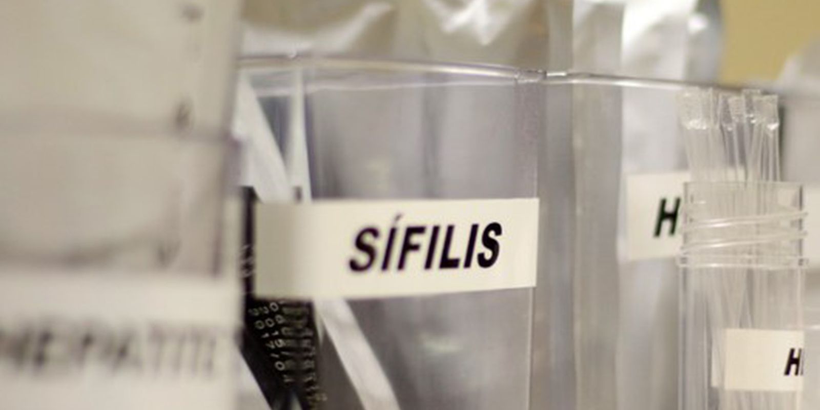 sifilis-continua-em-ritmo-acelerado-de-crescimento-no-pais