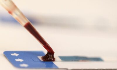 estudo-inedito-da-fiocruz-pode-ampliar-prevencao-de-hiv-entre-jovens