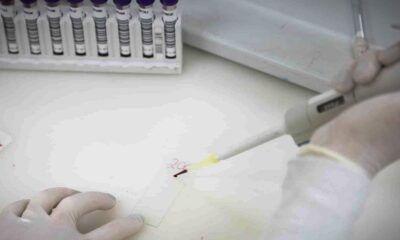 secretaria-de-saude-de-sp-investiga-novo-caso-suspeito-de-ebola